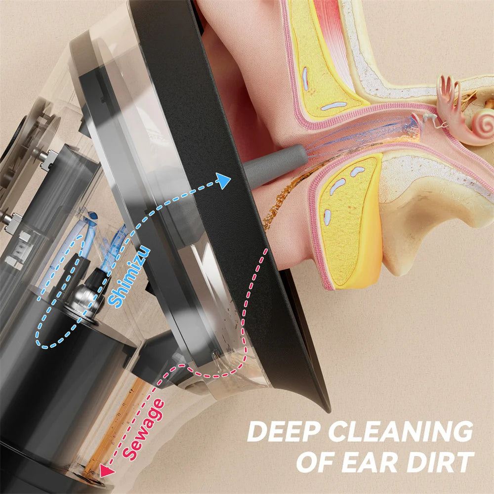 Electric Ear Wax Removal System. Cleaning ear
